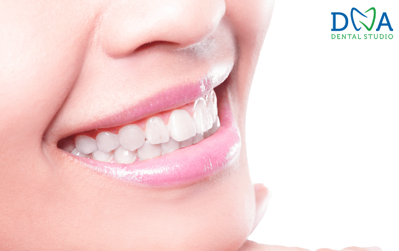 Dental Crowns in Burbank