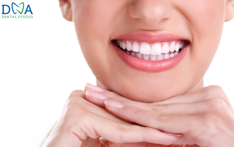 Teeth Whitening in Burbank