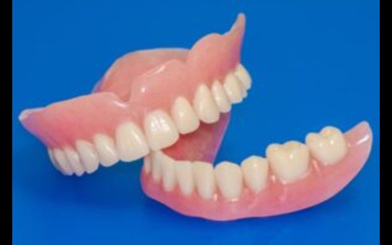 Partial Dentures - DNA Dental Studio - Burbank, CA