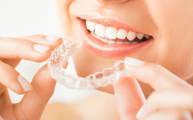 invisalign burbank