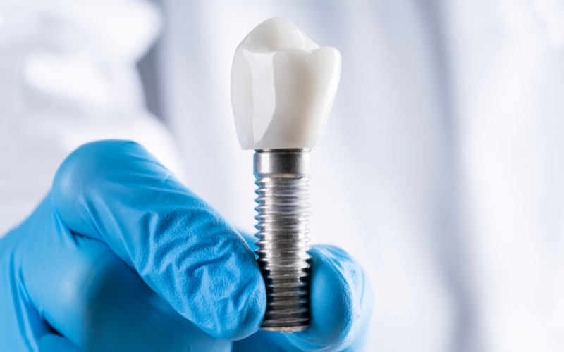 Implant Stronger Than a Natural Tooth